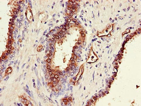 Polyclonal Rabbit anti-Human SORD / Sorbitol Dehydrogenase Antibody (IHC)