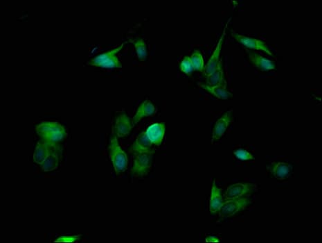 SPINK1 Antibody