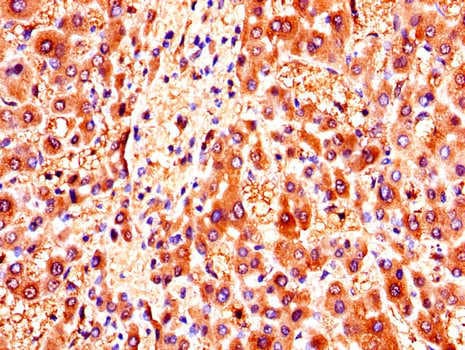 ZMPSTE24 Antibody
