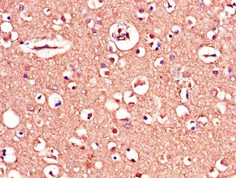 Polyclonal Rabbit anti-Human MAPT / Tau Antibody (IHC, IF, WB)