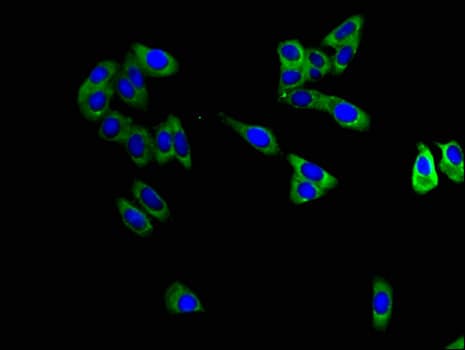 Polyclonal Rabbit anti-Human MAPT / Tau Antibody (IHC, IF, WB)