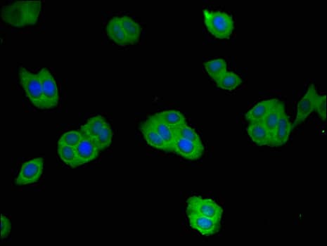 Polyclonal Rabbit anti-Human REN / Renin 1 Antibody (IF, WB)