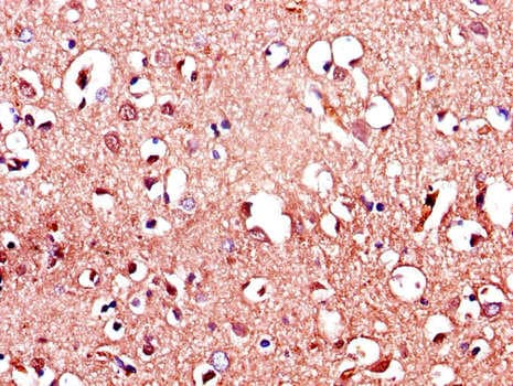 LRRTM4 Antibody