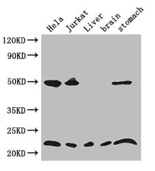 COMMD1 Antibody