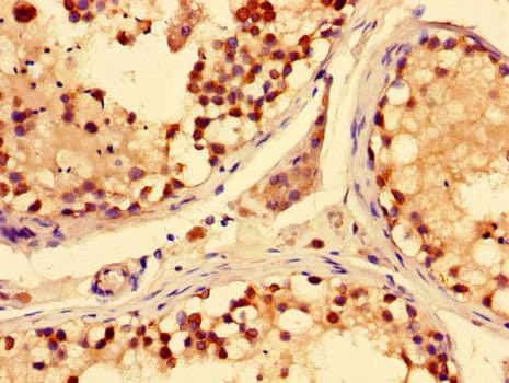 SLC28A3 Antibody