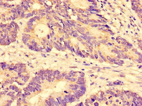 SLC28A3 Antibody