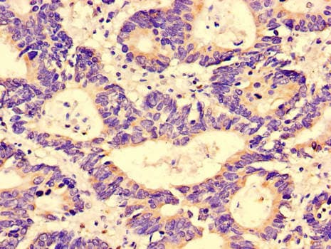 GGA1 Antibody