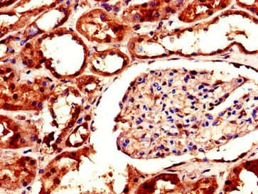 AKR1A1 Antibody