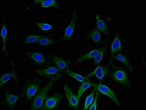 AKR1A1 Antibody
