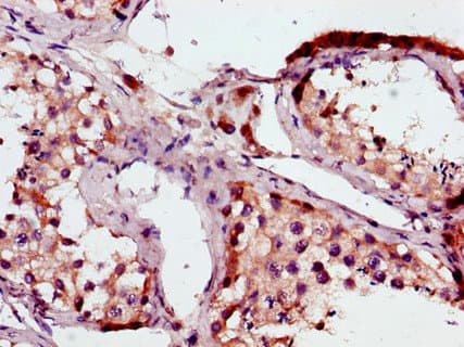 Polyclonal Rabbit anti-Human BRAF / B-Raf Antibody (IHC, IF)