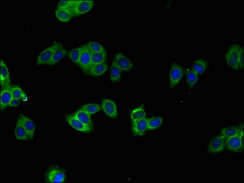 Polyclonal Rabbit anti-Human BRAF / B-Raf Antibody (IHC, IF)