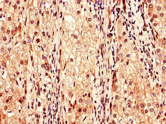 Polyclonal Rabbit anti-Human F9 / Factor IX Antibody (IHC, IF)