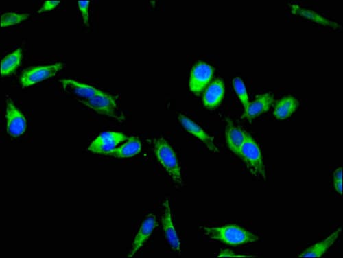 Polyclonal Rabbit anti-Human F9 / Factor IX Antibody (IHC, IF)