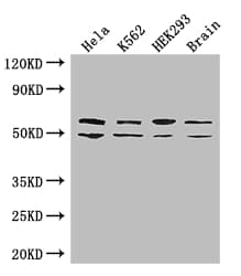 Polyclonal Rabbit anti-Human IMP-3 / IGF2BP3 Antibody (IHC, IF, WB)