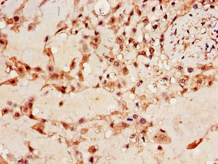 Polyclonal Rabbit anti-Human IMP-3 / IGF2BP3 Antibody (IHC, IF, WB)