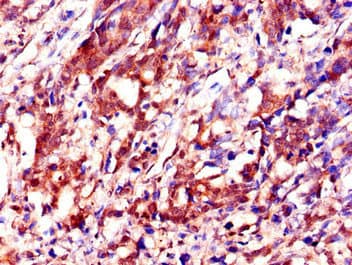 Polyclonal Rabbit anti-Human IMP-3 / IGF2BP3 Antibody (IHC, IF, WB)