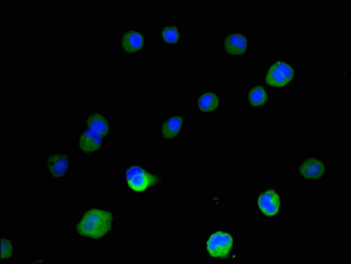 Polyclonal Rabbit anti-Human IMP-3 / IGF2BP3 Antibody (IHC, IF, WB)