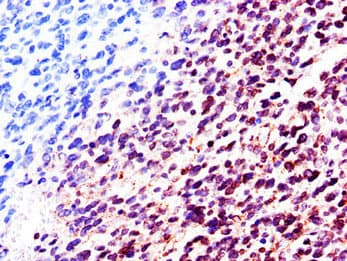 Polyclonal Rabbit anti-Human LMNB2 / Lamin B2 Antibody (IHC, IF, WB)
