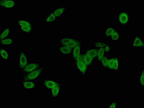 Polyclonal Rabbit anti-Human LMNB2 / Lamin B2 Antibody (IHC, IF, WB)