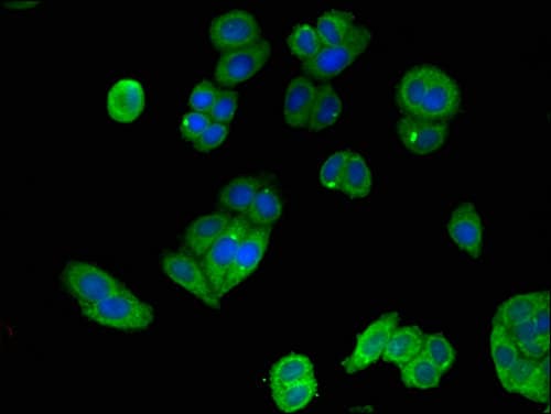 Polyclonal Rabbit anti-Human MAP2K4 / MKK4 Antibody (IF, WB)