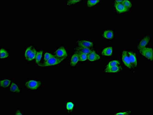 NNMT Antibody