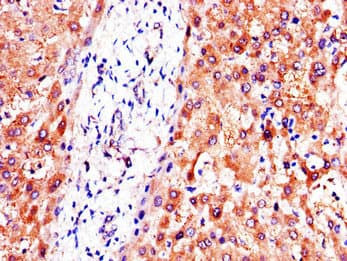 Polyclonal Rabbit anti-Human PC / Pyruvate Carboxylase Antibody (IHC, IF, WB)