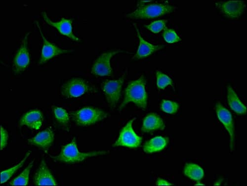 Polyclonal Rabbit anti-Human PC / Pyruvate Carboxylase Antibody (IHC, IF, WB)