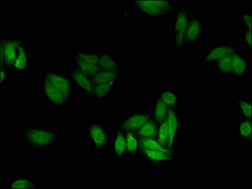 PFKFB2 Antibody
