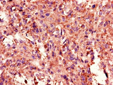 Polyclonal Rabbit anti-Human TANK Antibody (IHC, IF)