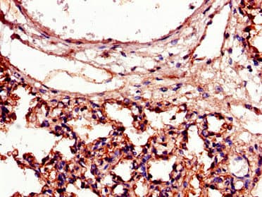 Polyclonal Rabbit anti-Human ICAM-1 / CD54 Antibody (IHC, IF)