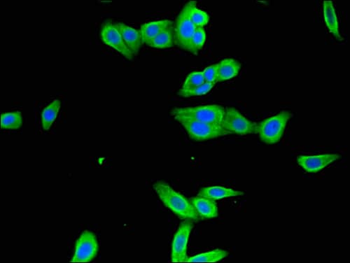 Polyclonal Rabbit anti-Human ICAM-1 / CD54 Antibody (IHC, IF)