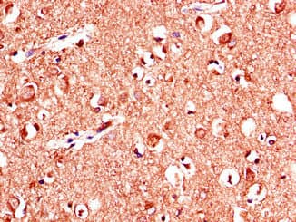 Polyclonal Rabbit anti-Human KL / Klotho Antibody (IHC, IF)