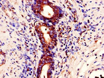 Polyclonal Rabbit anti-Human STAU1 / Staufen Antibody (IHC, IF, WB)