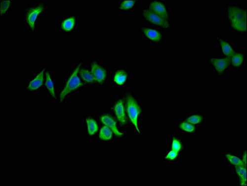 Polyclonal Rabbit anti-Human STAU1 / Staufen Antibody (IHC, IF, WB)