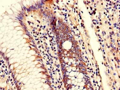 TRIM25 Antibody