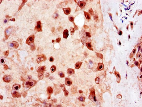 USP25 Antibody