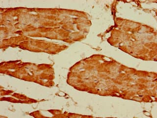 Polyclonal Rabbit anti-Human GRIN2C / NMDAR2C / NR2C Antibody (IHC, IF)