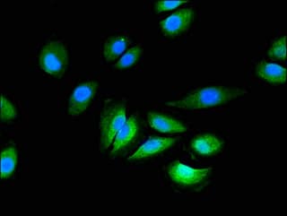 Polyclonal Rabbit anti-Human GRIN2C / NMDAR2C / NR2C Antibody (IHC, IF)