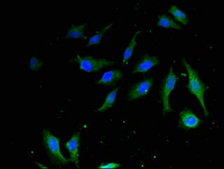 Polyclonal Rabbit anti-Human HMG1 / HMGB1 Antibody (IHC, IF)