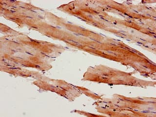 Polyclonal Rabbit anti-Human MLC2 / MYL9 Antibody (IHC, IF)
