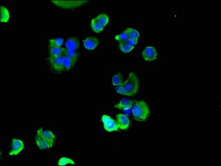 Polyclonal Rabbit anti-Human MLC2 / MYL9 Antibody (IHC, IF)