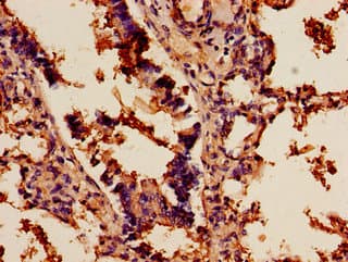 Polyclonal Rabbit anti-Human SCD1 / SCD Antibody (IHC)