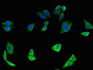 Polyclonal Rabbit anti-Human TLR7 / CD287 Antibody (IF)