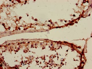 SLC15A3 Antibody