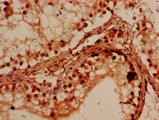 PRMT7 Antibody