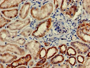 Polyclonal Rabbit anti-Human Complement C6 Antibody (IHC, WB)