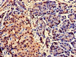 Polyclonal Rabbit anti-Human C/EBP Alpha / CEBPA Antibody (IHC)