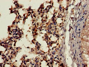 Polyclonal Rabbit anti-Human CTSH / Cathepsin H Antibody (IHC, WB)