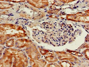 Polyclonal Rabbit anti-Human CTSH / Cathepsin H Antibody (IHC, WB)