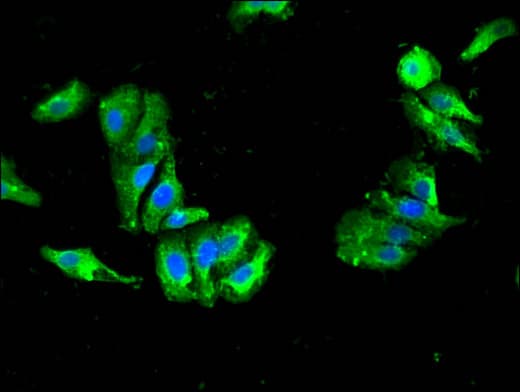 Polyclonal Rabbit anti-Human DDC / DOPA Decarboxylase Antibody (IHC, IF)